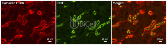 NCC (SLC12a3) Antibody - Western Blot Validated