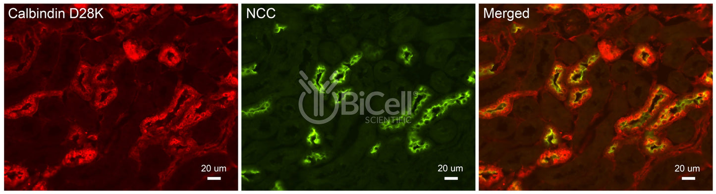 NCC (SLC12a3) Antibody - FFPE Validated