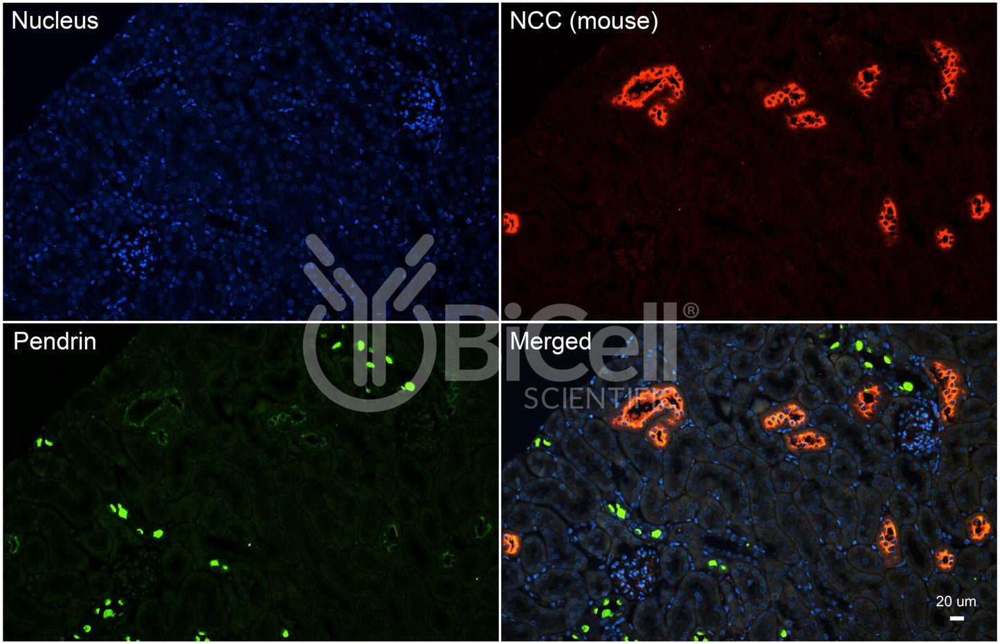 NCC (SLC12a3) (mouse) Antibody - Western Blot Validated