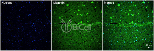Nicastrin (NCSTN) Antibody - Western Blot Validated