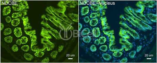 NDCBE (Slc4a8) Antibody