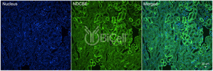 NDCBE (Slc4a8) Antibody - Western Blot Validated