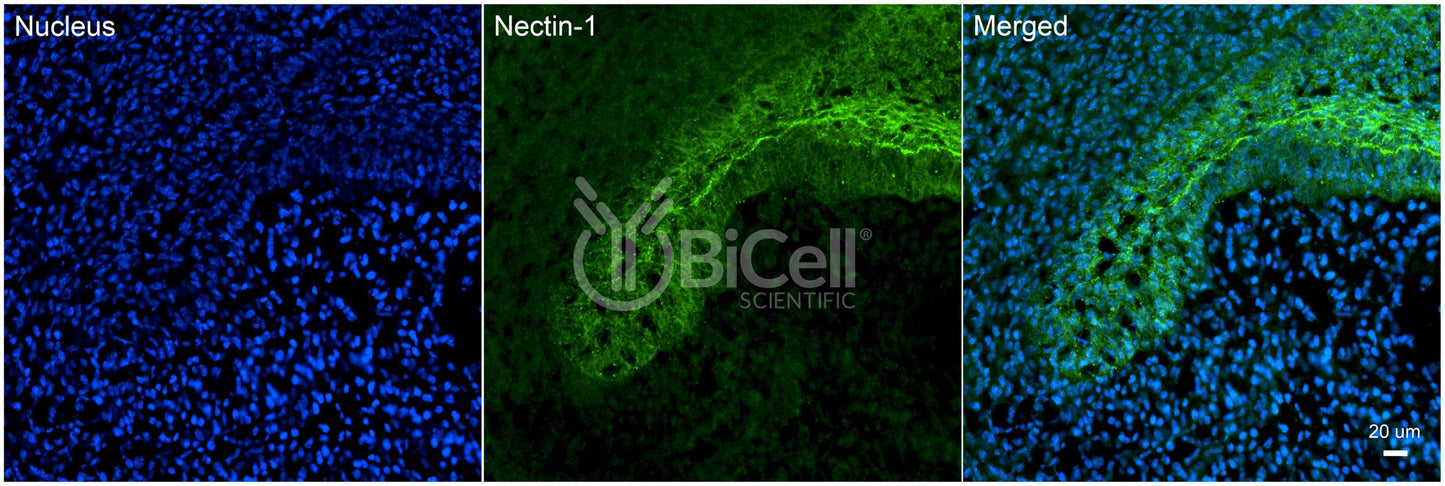 Nectin-1 (HVEC or CD111) Antibody - Western Blot Validated