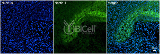 Nectin-1 (HVEC or CD111) Antibody - FFPE Validated