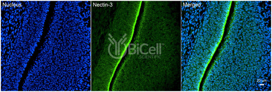 Nectin-3 (CD113) Antibody - Western Blot Validated