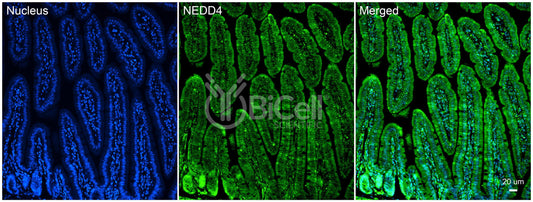 NEDD4 (RPF1) Antibody - FFPE Validated