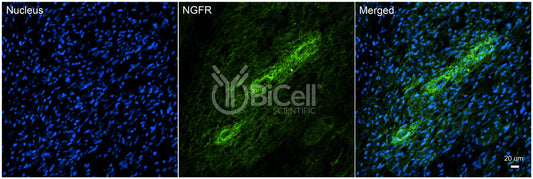 NGFR (TNFRSF16 or CD271) Antibody - Western Blot Validated