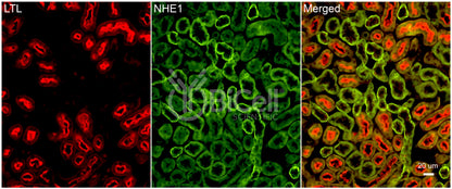 NHE1 (Slc9a1) Antibody - Western Blot Validated
