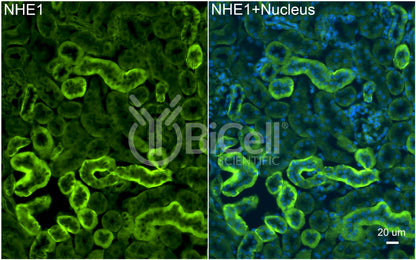 NHE1 (Slc9a1) (rat) Antibody