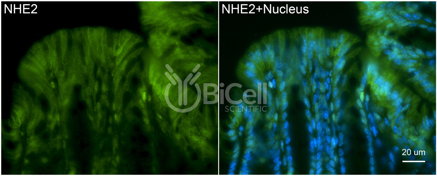 NHE2 (Slc9a2) (rat) Antibody - Western Blot Validated