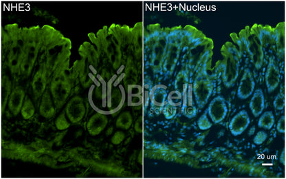 NHE3 (Slc9a3) Antibody - Western Blot Validated