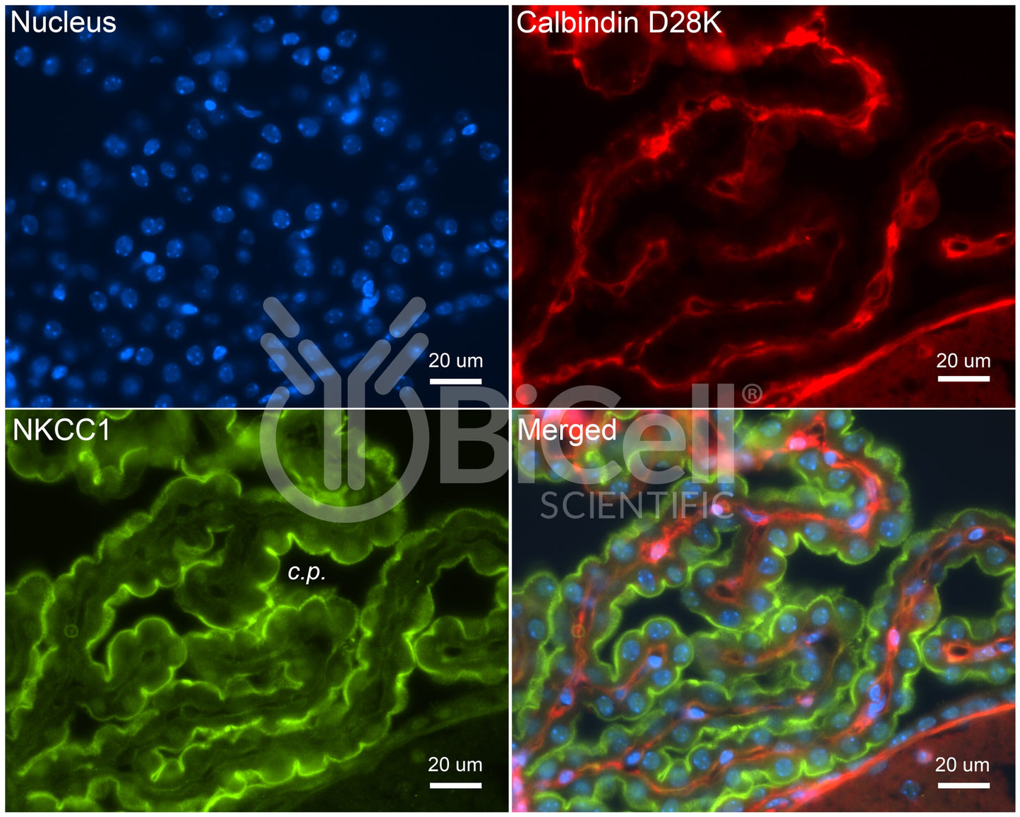 NKCC1 (Slc12a2) Antibody - Western Blot Validated