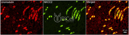 NKCC2 (Slc12a1) Antibody - Western Blot Validated
