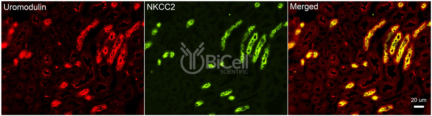 NKCC2 (Slc12a1) Antibody