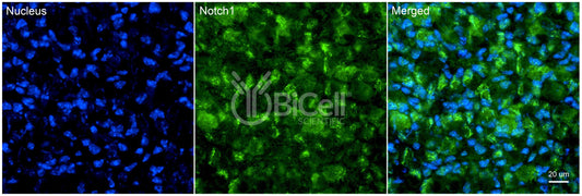 NOTCH1 Antibody - Western Blot Validated