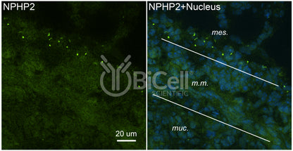 Nephrocystin-2 (NPHP2 or Inversin or INVS) Antibody - Western Blot Validated