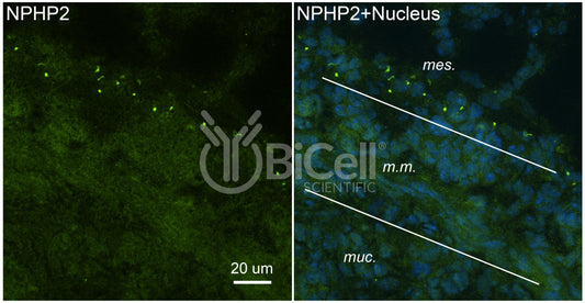 Nephrocystin-2 (NPHP2 or Inversin or INVS) Antibody