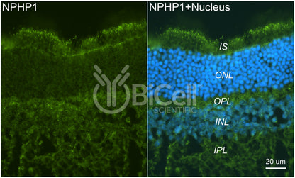 Nephrocystin-1 (NPHP1) Antibody - FFPE Validated