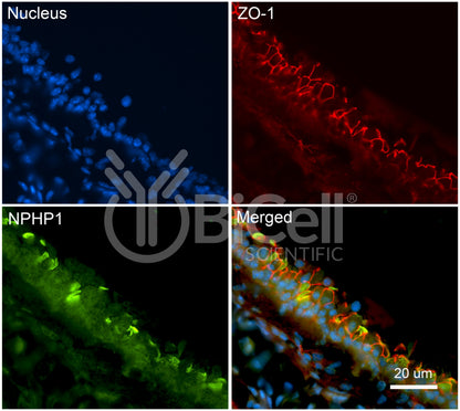 Nephrocystin-1 (NPHP1) Antibody - Western Blot Validated