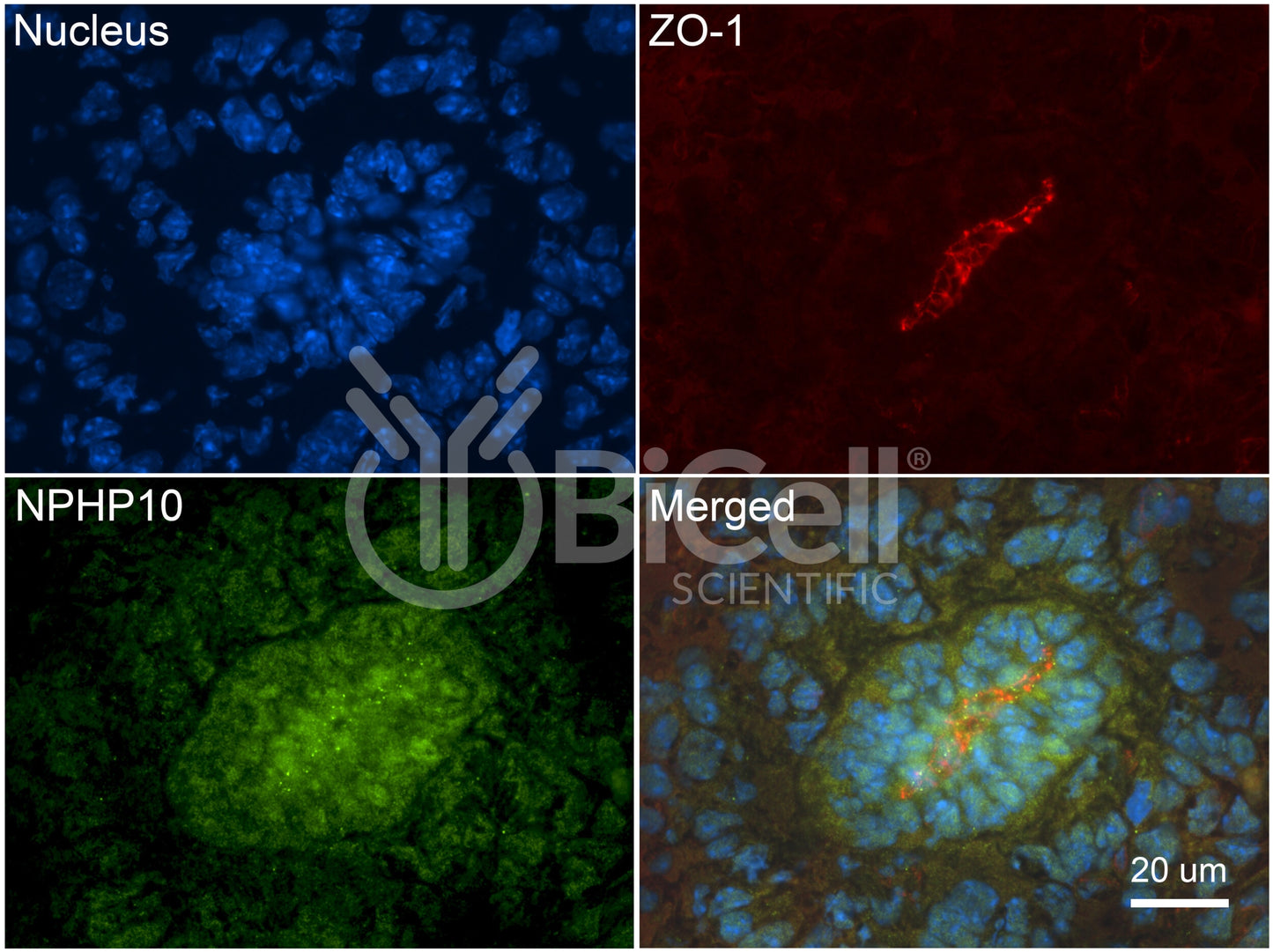 Nephrocystin-10 (NPHP10 or SDCCAG8 or BBS16) Antibody - Western Blot Validated