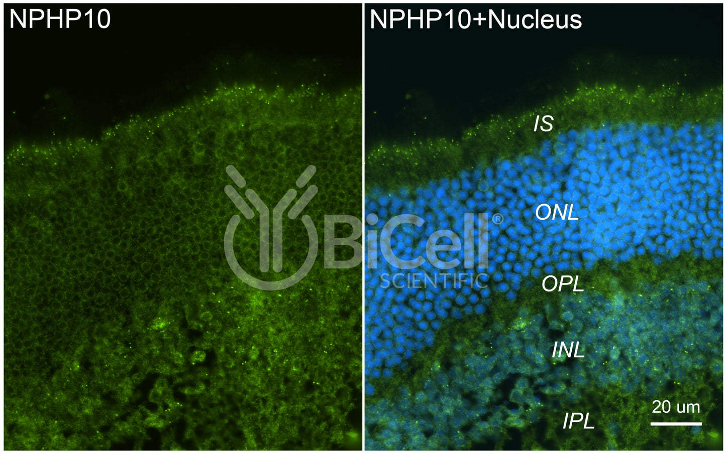 Nephrocystin-10 (NPHP10 or SDCCAG8 or BBS16) Antibody - Western Blot Validated