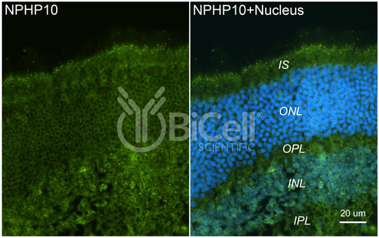 Nephrocystin-10 (NPHP10 or SDCCAG8 or BBS16) Antibody - Western Blot Validated