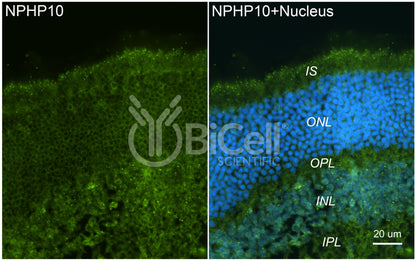 Nephrocystin-10 (NPHP10 or SDCCAG8 or BBS16) Antibody - FFPE Validated