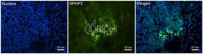 Nephrocystin-3 (NPHP3 or MKS7) Antibody - FFPE Validated