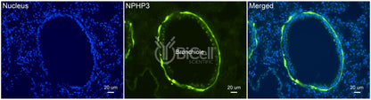 Nephrocystin-3 (NPHP3 or MKS7) Antibody - Western Blot Validated