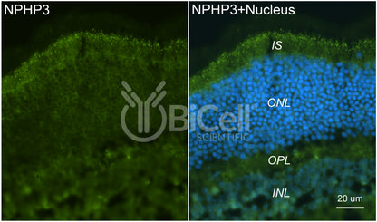 Nephrocystin-3 (NPHP3 or MKS7) Antibody - Western Blot Validated