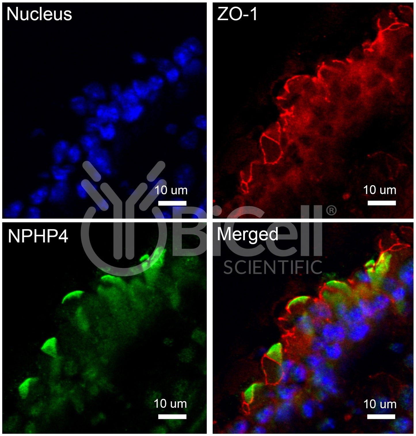 Nephrocystin-4 (NPHP4) Antibody - Western Blot Validated