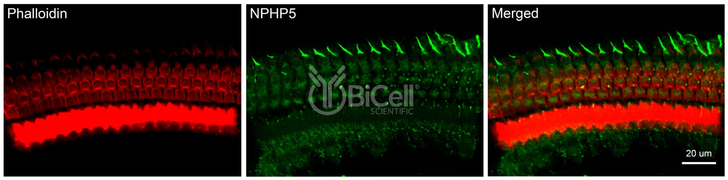 Nephrocystin-5 (NPHP5 or IQCB1) Antibody - FFPE Validated