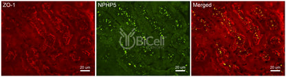 Nephrocystin-5 (NPHP5 or IQCB1) Antibody - Western Blot Validated