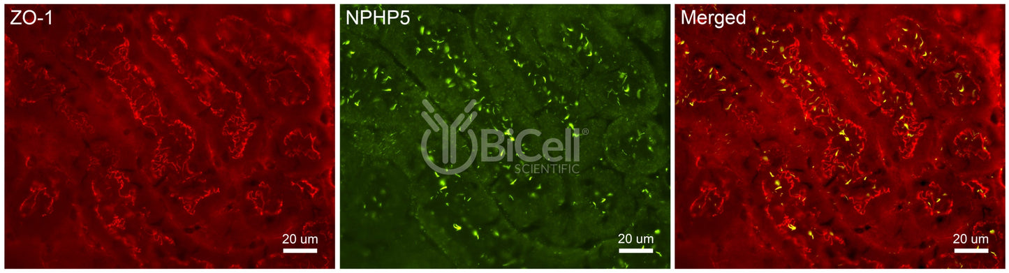Nephrocystin-5 (NPHP5 or IQCB1) Antibody