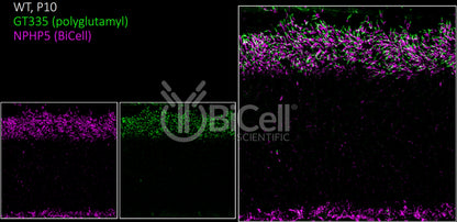 Nephrocystin-5 (NPHP5 or IQCB1) Antibody - FFPE Validated