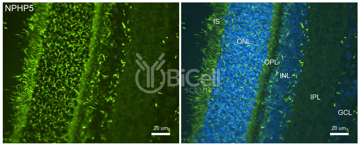 Nephrocystin-5 (NPHP5 or IQCB1) Antibody - Western Blot Validated
