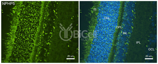 Nephrocystin-5 (NPHP5 or IQCB1) Antibody - Western Blot Validated