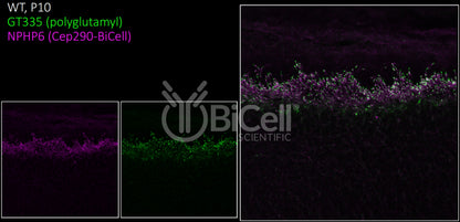 Nephrocystin-6 (NPHP6 or CEP290 or MKS4 or BBS14) Antibody