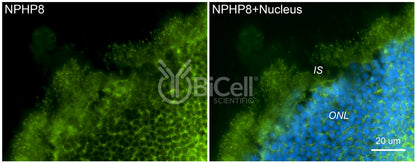Nephrocystin-8 (NPHP8 or MKS5 or RPGRIP1L) Antibody