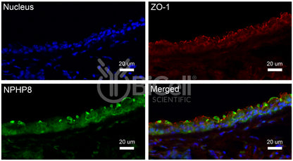 Nephrocystin-8 (NPHP8 or MKS5 or RPGRIP1L) Antibody
