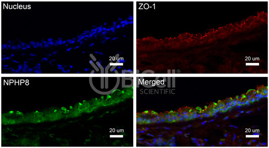 Nephrocystin-8 (NPHP8 or MKS5 or RPGRIP1L) Antibody