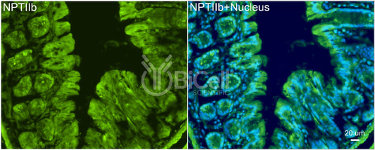 NPT2b (SLC34a2) Antibody - Western Blot Validated