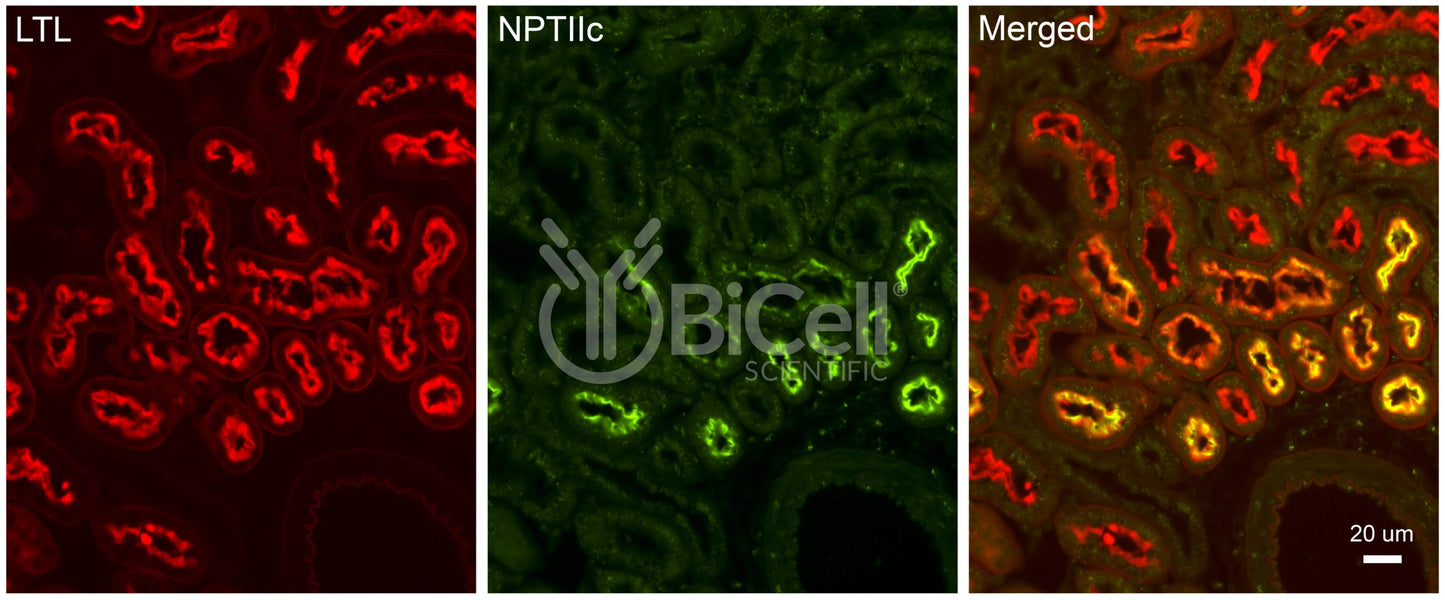 NPT2c (SLC34a3) Antibody - FFPE Validated