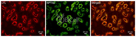 NPT2a (SLC34a1) Antibody - FFPE Validated