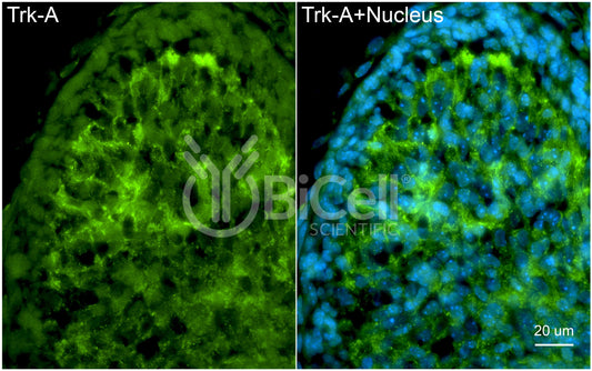 Trk-A (NTRK1) Antibody