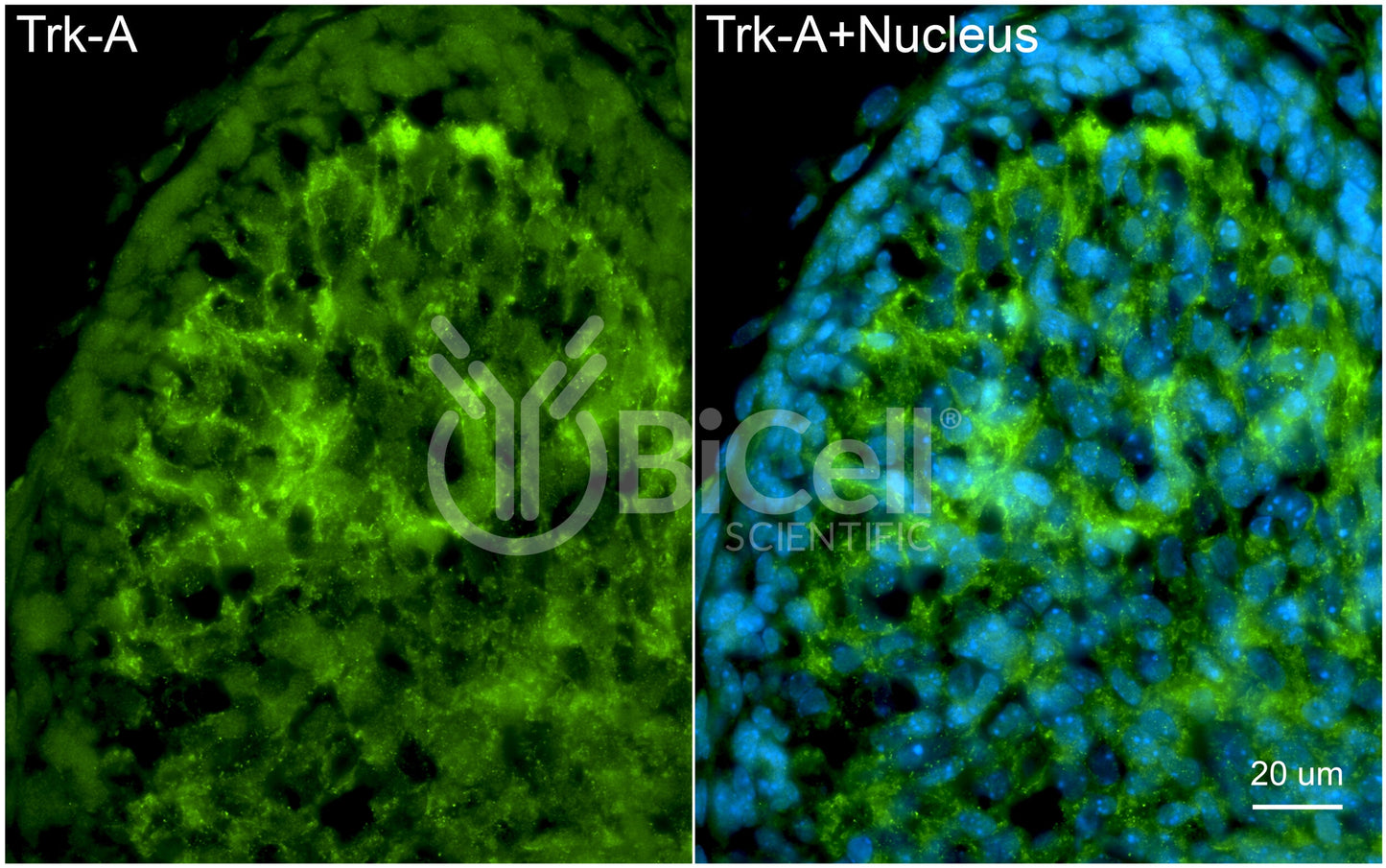 Trk-A (NTRK1) Antibody - FFPE Validated