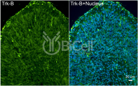 Trk-B (NTRK2) (C-Terminus) (Cytoplasmic) Antibody - FFPE Validated