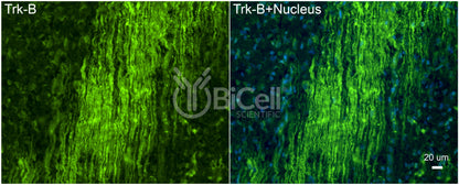 Trk-B (NTRK2) (C-Terminus) (Cytoplasmic) Antibody