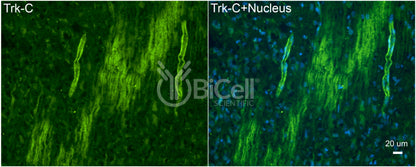 Trk-C (NTRK3) Antibody - Western Blot Validated