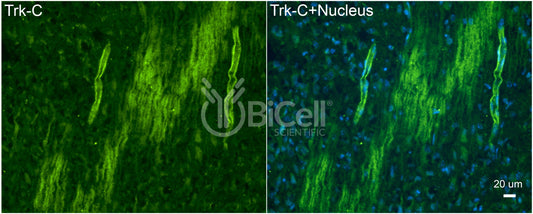 Trk-C (NTRK3) Antibody - FFPE Validated